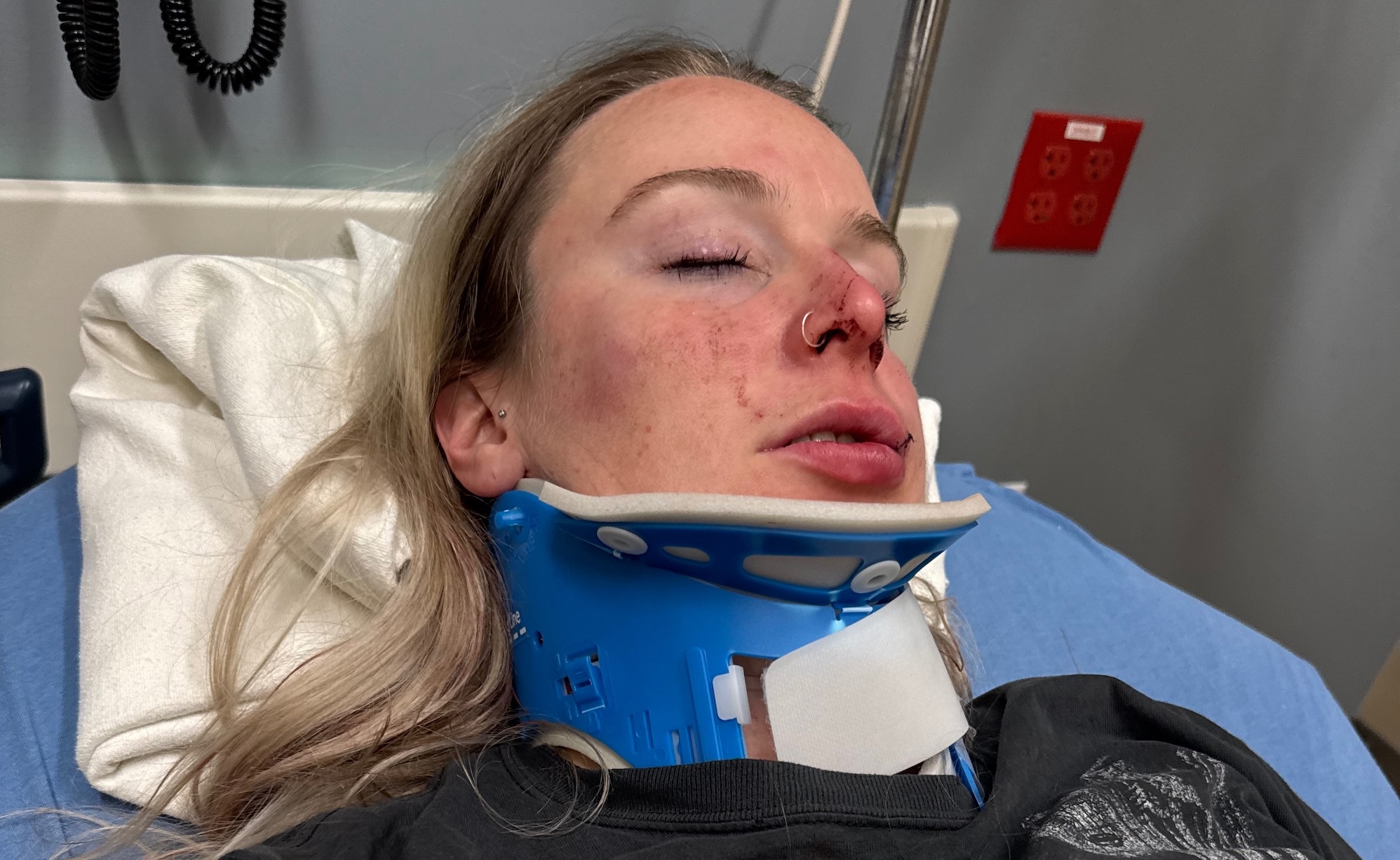 Coppia lesbica cita in giudizio il casinò dopo presunto attacco omofobo brutale: «Non hanno fatto nulla»