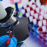 Figi dichiara emergenza nazionale per l'HIV: 1 adulto su 60 è colpito