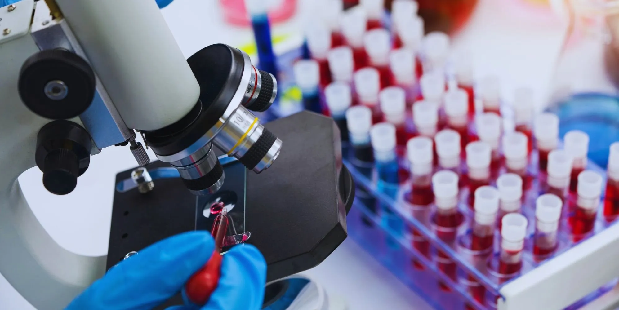 Figi dichiara emergenza nazionale per l'HIV: 1 adulto su 60 è colpito